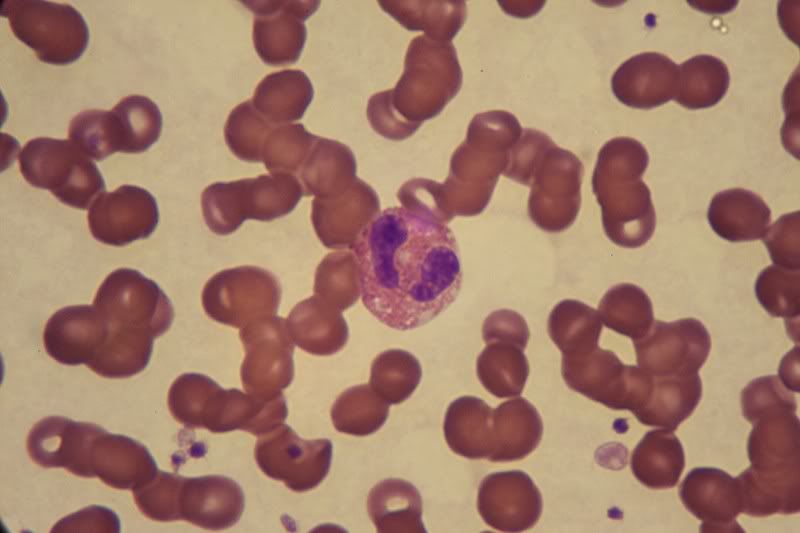 IMAGE: http://i154.photobucket.com/albums/s254/drevilsmom/eosinophil.jpg