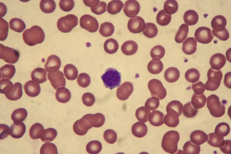 IMAGE: http://i154.photobucket.com/albums/s254/drevilsmom/lymphocyte.jpg
