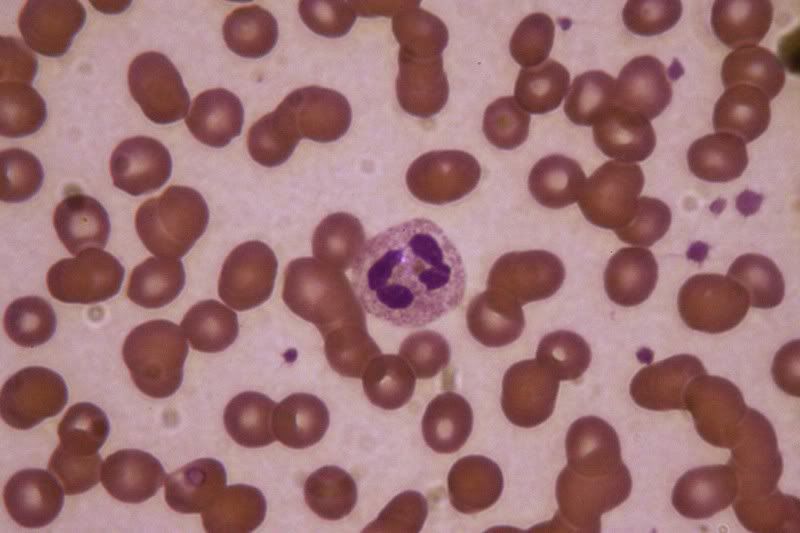 IMAGE: http://i154.photobucket.com/albums/s254/drevilsmom/segmentedneutrophil.jpg